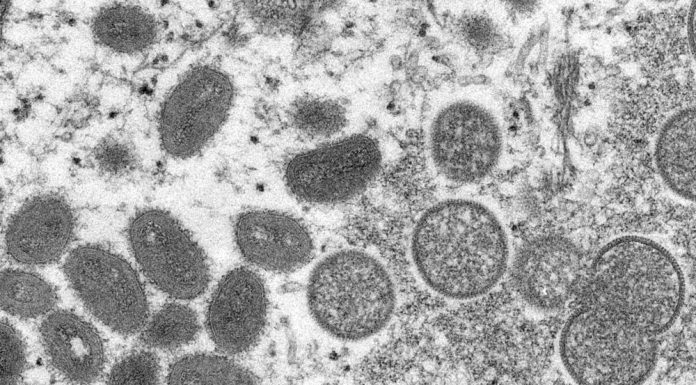 African scientists baffled by monkeypox cases in Europe, US